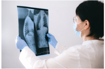 Зробити флюорографію в Києві: швидка діагностика легень