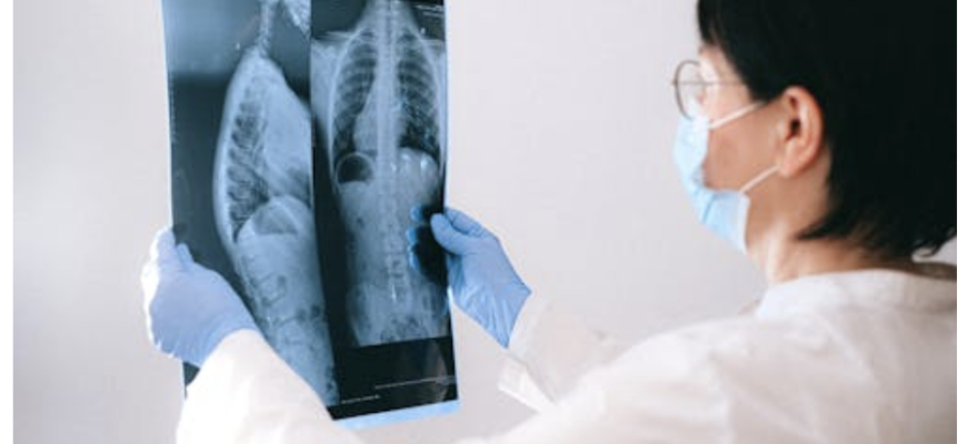 Зробити флюорографію в Києві: швидка діагностика легень